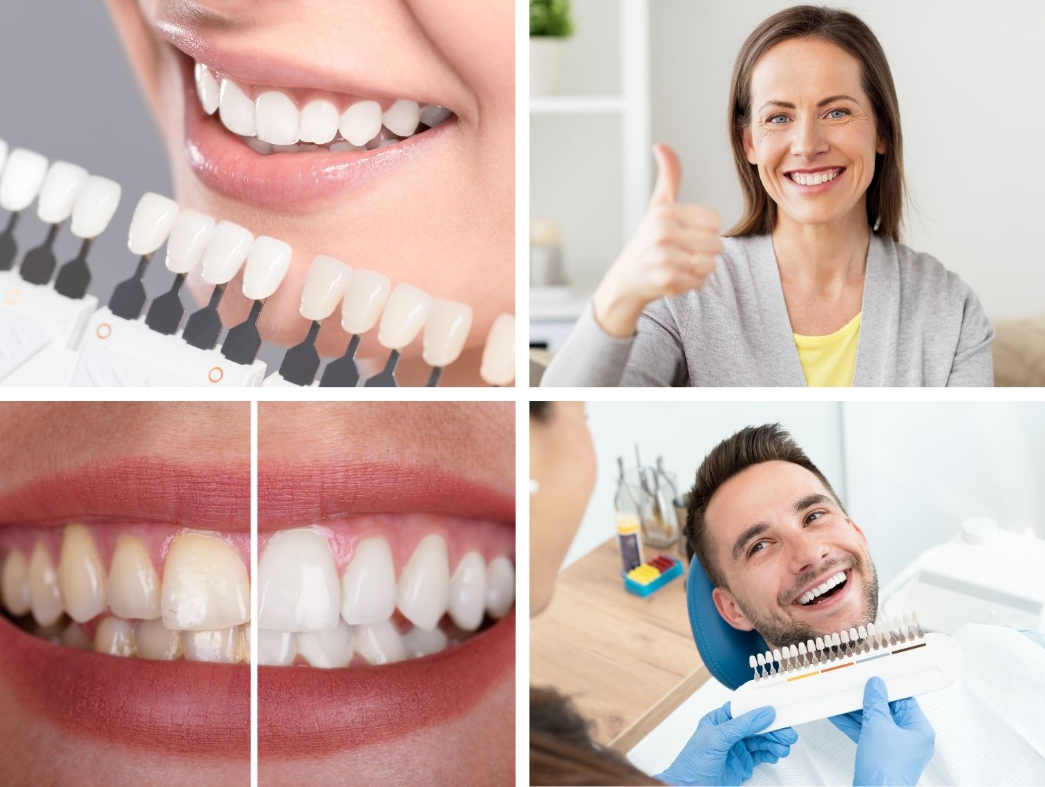 service-page-teeth-whitening