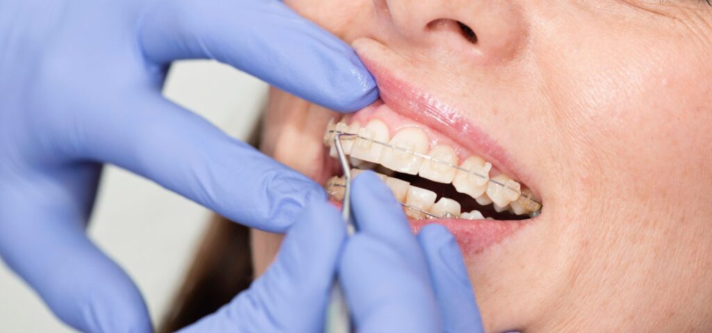 Orthodontics & Invisalign  Smile Dental Implant Center