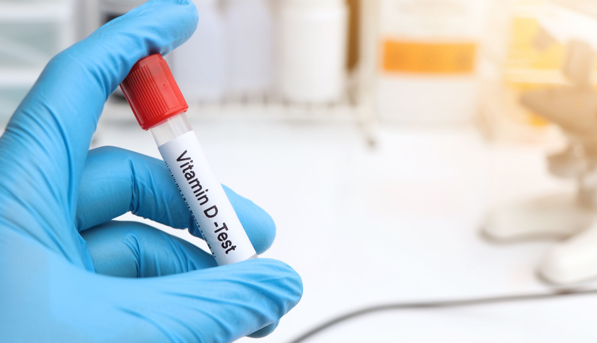 Featured Image - Vitamin D Testing